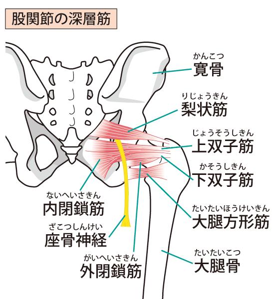 坐骨神経痛